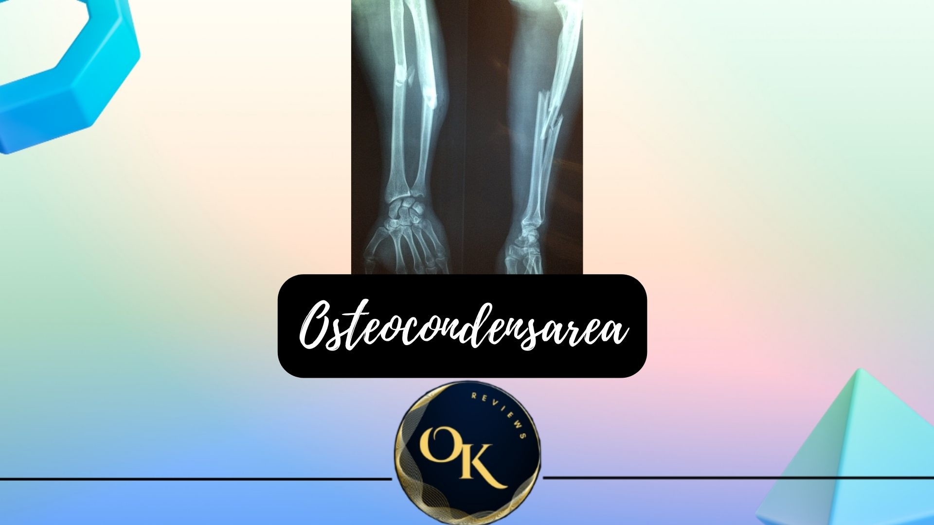 osteocondensare
