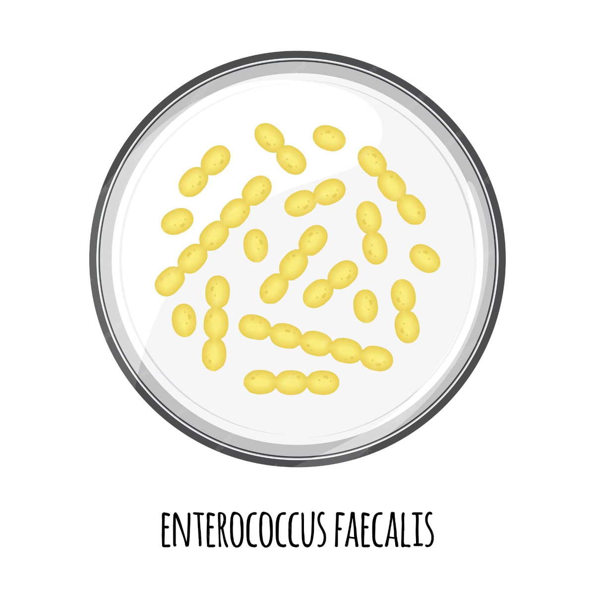 Enterococcus-faecalis.jpg